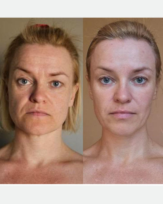 Buccal and face sculpting massage before and after, real client result without retouching
